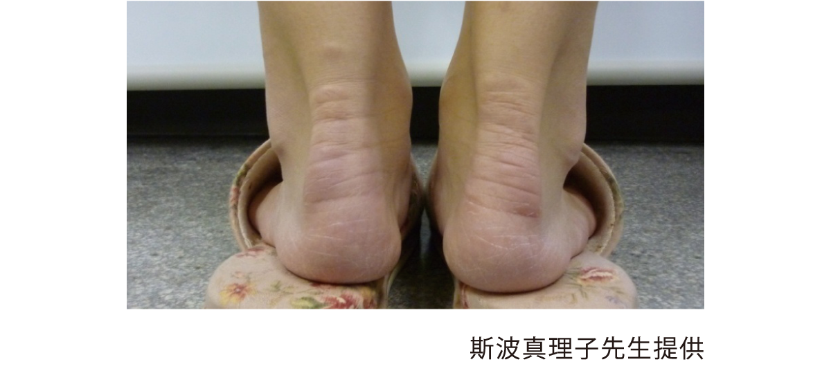 家族性高コレステロール血症 Fh について 心筋梗塞 不安定狭心症で入院中の方とそのご家族へ再発予防ガイド